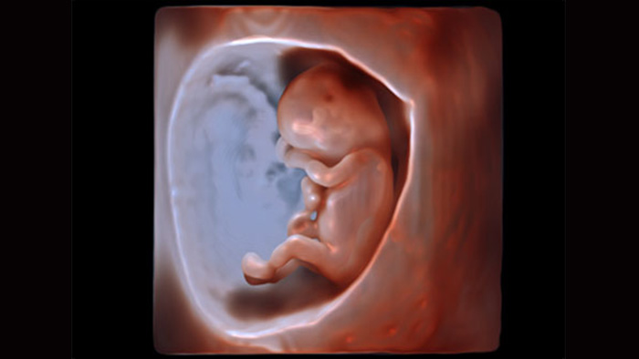 Philips GlassVue EPIQ First Trimester OB Light source